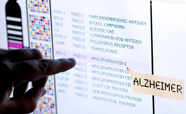 Gene Therapy May Treat Alzheimer's
