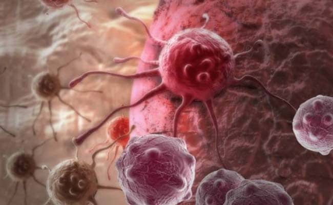 Small Implanted Device Can Fight Breast Cancer