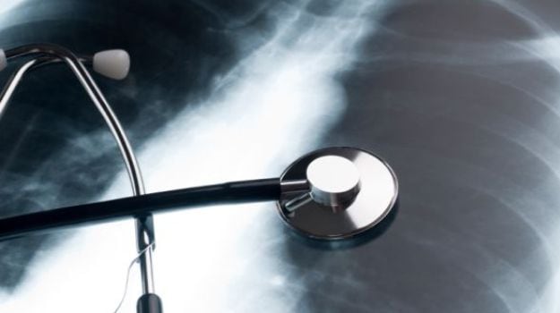 Middle Aged People More Likely to be Diagnosed with Lung Cancer
