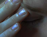 Headaches in kids may resolve over time