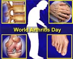 World Arthritis Day 2009