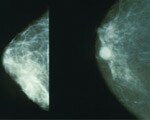 Mammograms for women under 50
