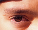 Preventing conjunctivitis