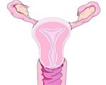 Well-being after hysterectomy Well-being after hysterectomy