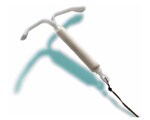 IUD safe right after abortion, miscarriage IUD safe right after abortion, miscarriage