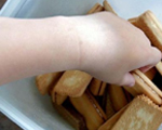 Obese children's wrist size predicts heart disease