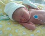 Premature babies and autism risk Premature babies and autism risk