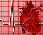 Stroke risk higher in HIV patients Stroke risk higher in HIV patients