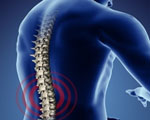 Signs that you have sciatica