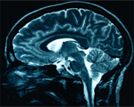 Stroke patients regain function at home