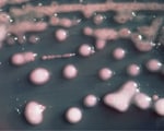 Superbug - is it really from India? Superbug - is it really from India?