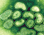 Asthma worsens H1N1 flu Asthma worsens H1N1 flu