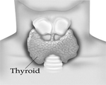 Thyroid raises stroke risk in young adults