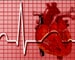 Stet can show heart attack risk