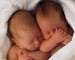 Twins more prone to diabetes