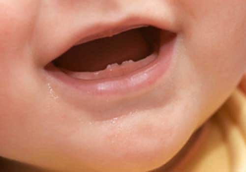 Take care of your baby's teeth