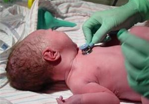 Childbirth