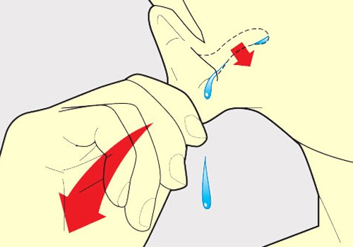 Otitis media Otitis media