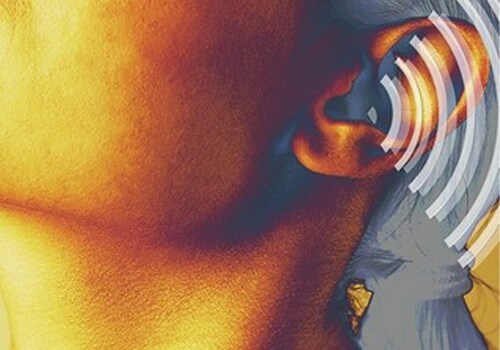 Otitis media Otitis media