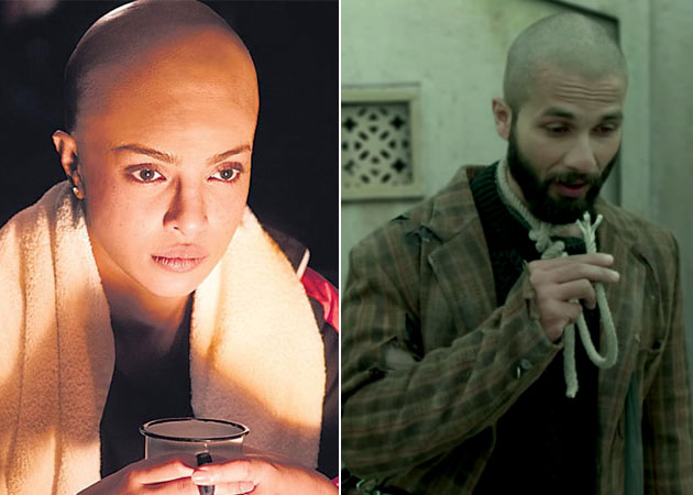 Bald, Bold and Beautiful: Priyanka, Shahid, Ranveer Are Losing Their Hair