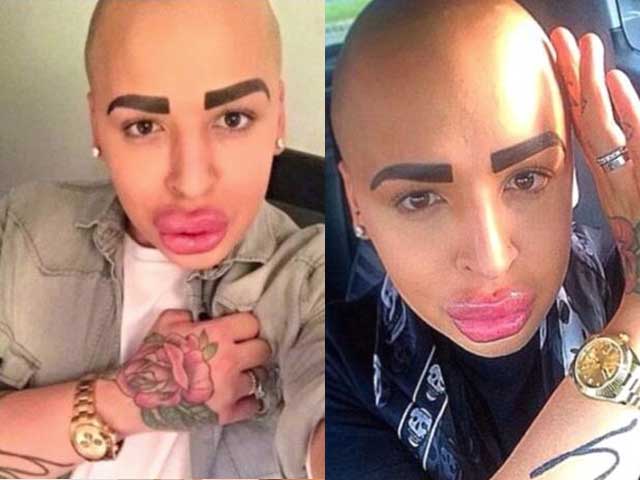 Man Spends 150,000 Dollars to Look Like Kim Kardashian