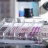 Most Cancer Cases are Caused by Bad Luck: Study Most Cancer Cases are Caused by Bad Luck: Study