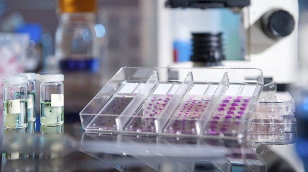 Most Cancer Cases are Caused by Bad Luck: Study
