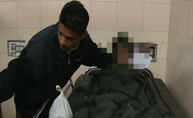 11-Year-Old In Critical Condition, Indore Cop Allegedly Set Her On Fire