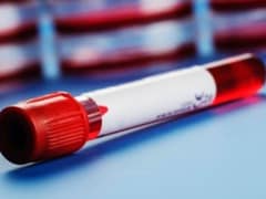 Detect Cancer Early With a Simple Blood Test: Scientists Detect Cancer Early With a Simple Blood Test: Scientists
