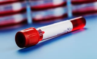 Detect Cancer Early With a Simple Blood Test: Scientists