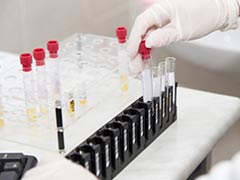 AIDS Epidemic Can End by 2030: UNAIDS