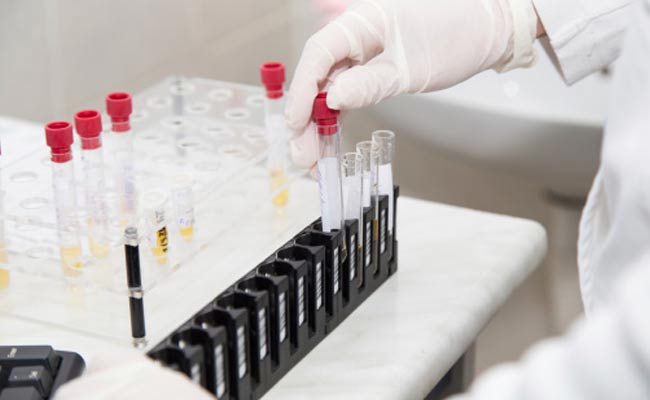 Opinion | The World Can No Longer Ignore Bioterrorism As A Threat