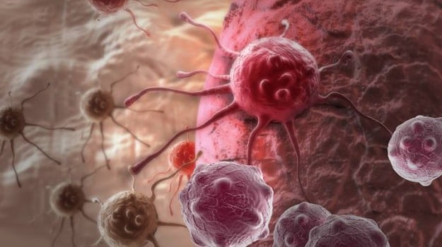 Soon, Personalised Medication for Patients With Prostate Cancer?