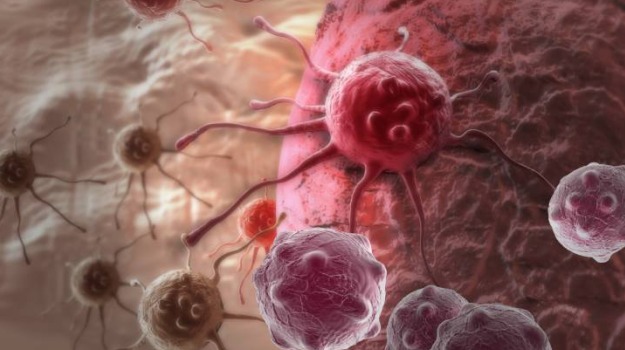 2-step Therapy for Breast Tumour Shows Promise