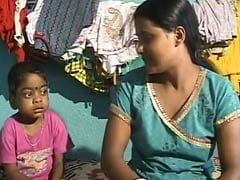 In Bengaluru, 5-Year-Old With Rare Disorder Needs Help