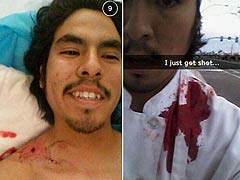 'I Just Got Shot!' US Boy Posts Bloody Selfie Online