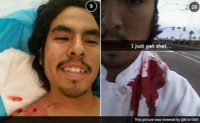 'I Just Got Shot!' US Boy Posts Bloody Selfie Online