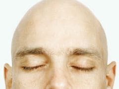 New Drugs That May Cure Baldness Found