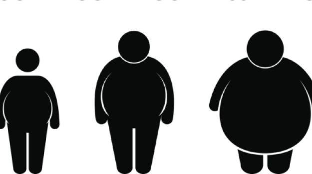 Obesity in South Asia 'Beyond Expectation'