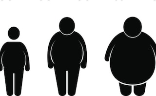 Obesity in South Asia 'Beyond Expectation'