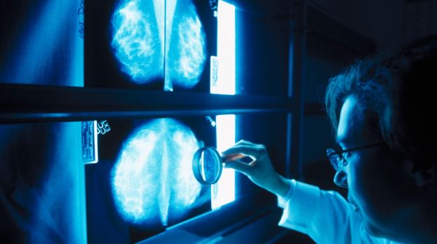 17% of Women Diagnosed With Breast Cancer 'Waited Over A Month to See GP'