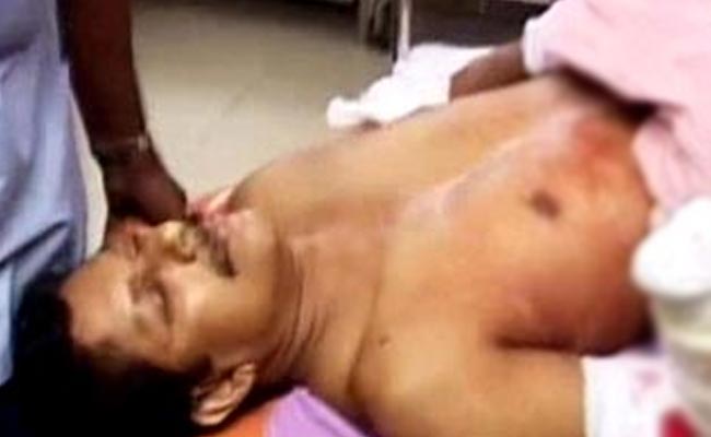 Forgiven All, Says Kerala Professor After 13 Convicted for Chopping His Hand