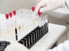 US To Establish Lab Network For Combating 'Superbugs'