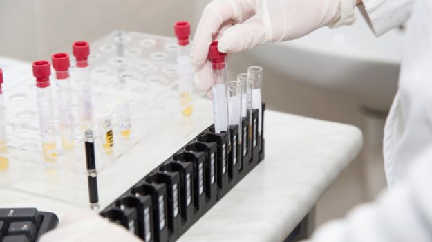 Super-Sensitive Ebola Test Could Curb Disease Spread