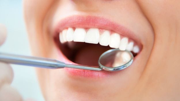 Tooth Cavities Increases the Risk of Heart Disease, Says Study