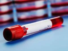 Now, Analyse Your Blood Sample With a Credit Card-Sized Device Now, Analyse Your Blood Sample With a Credit Card-Sized Device