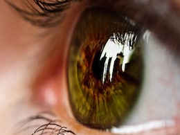 Retinoblastoma Rising Among Indian Children: AIIMS Retinoblastoma Rising Among Indian Children: AIIMS