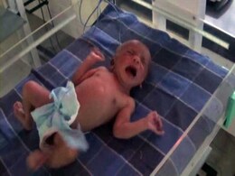 Newborn Forced to Walk by Witch Doctor in Assam Village as Fever Cure Newborn Forced to Walk by Witch Doctor in Assam Village as Fever Cure