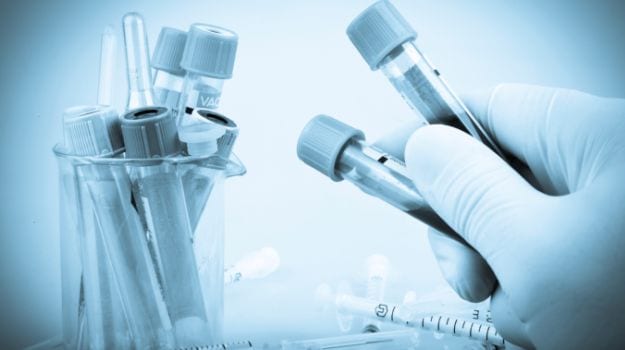 Cancer Vaccine Found Effective In Mice: Research