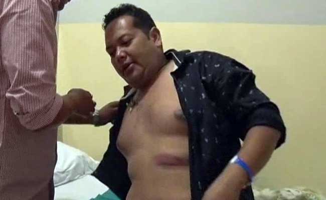 #NoVIP: Manipur Speaker Allegedly Watched his Team Attack Man For Not Giving Way